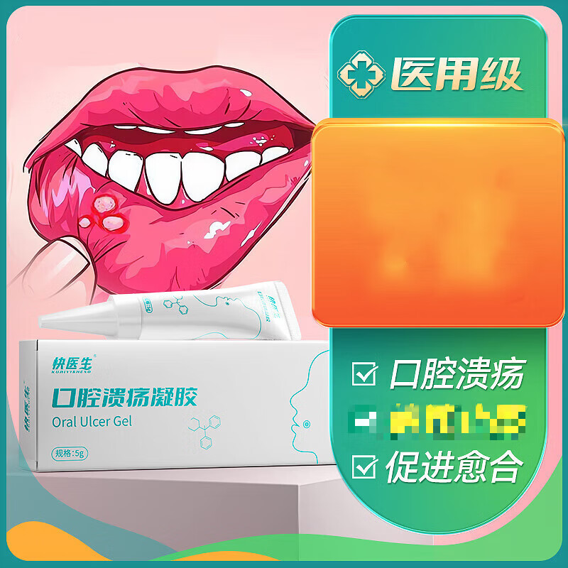 快医生口腔溃疡凝胶贴儿童口疮专用创面愈合散修复液舌头 1支 1支5g