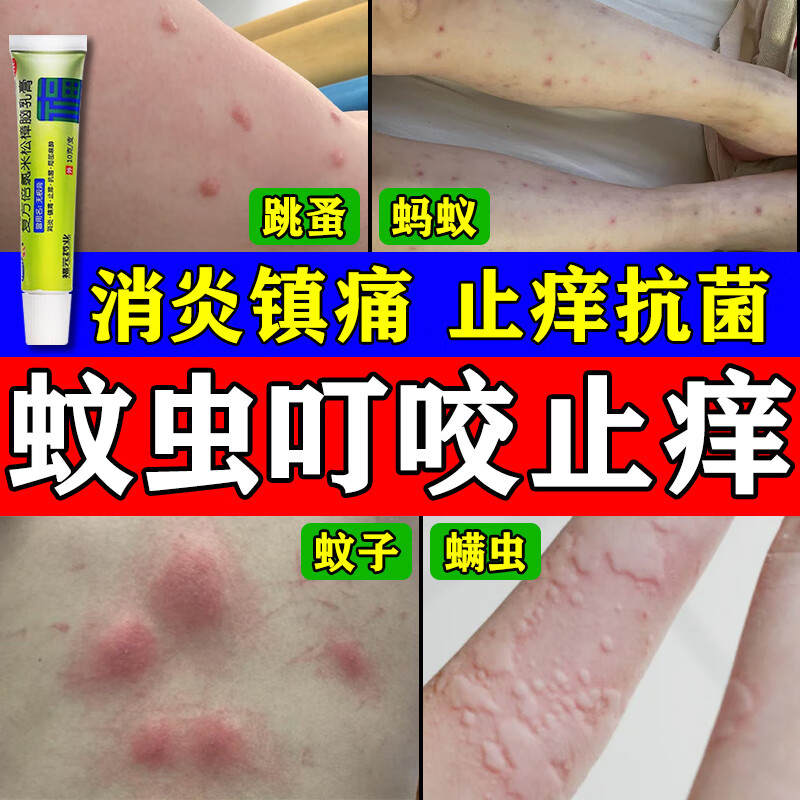 蚊虫叮咬止痒消肿药膏】虫咬皮炎皮肤瘙痒红肿跳蚤蚊子隐翅虫叮咬起包