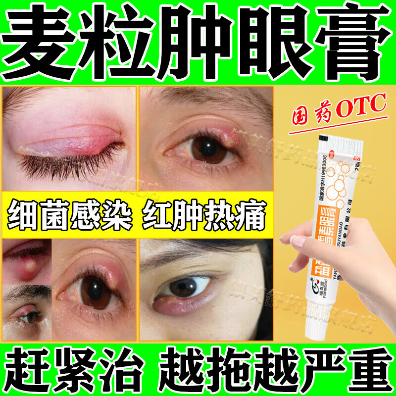 麦粒肿眼膏 治麦粒肿 眼睛不舒服红肿痒 针眼撅眼沙眼细菌性眼睑炎