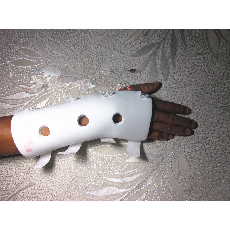 克雷氏高分子可塑型骨折固定夹板夹板 克雷氏塑型夹板 骨夹板 高分子