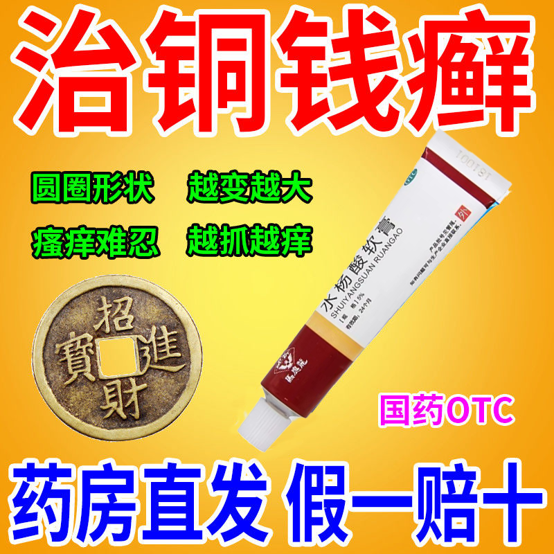 铜钱癣专用药膏 真菌感染皮肤用 皮肤癣花斑癣头皮癣体股癣手足癣皮肤