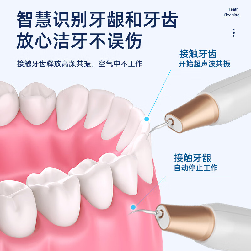 志高(CHIGO)超声波洁牙器洗牙器结石去清除洁器洗牙清洁烟渍茶渍七夕情人节礼物送女男友实用送爸爸 皓月白 2支喷头 尖*1宽*1 【真·超声波+全套洁牙工具】
