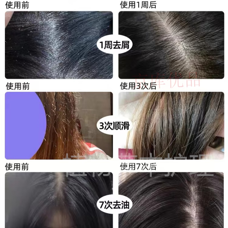 茶麸洗发水山茶籽控油去屑止痒防掉发断发蓬松柔顺儿童宝妈适用 1瓶 400ml/瓶
