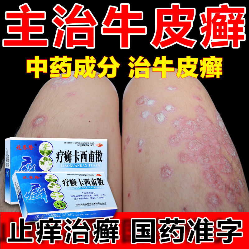 治疗牛皮癣药i膏真菌止痒抑菌皮肤牛皮癣专效用药顽固牛皮癣银屑病