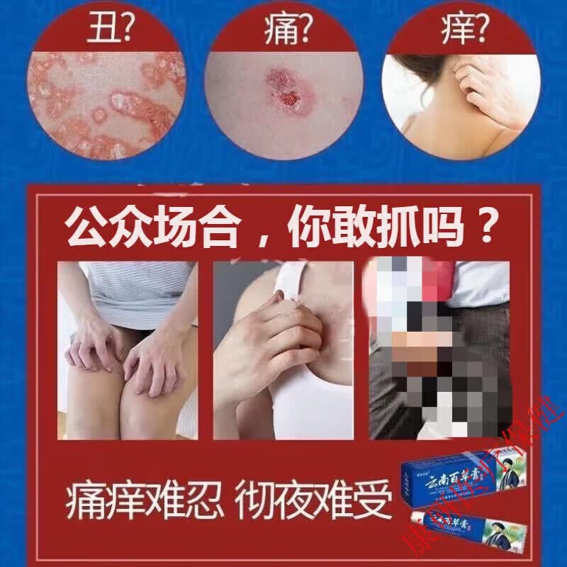 私处皮炎膏皮痒膏草本膏大腿内侧阴囊潮湿痒瘙痒草本乳膏皮痒宝阴痒膏