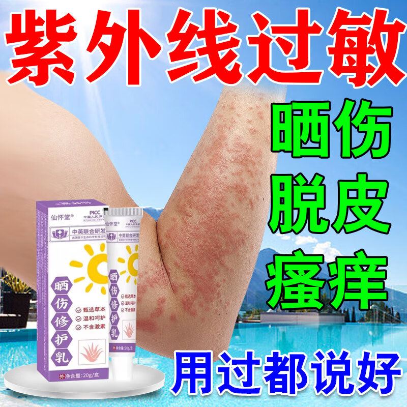 zisiz晒伤修复药膏芦荟胶修复皮肤晒后修复紫外线过敏 晒伤修护乳20g