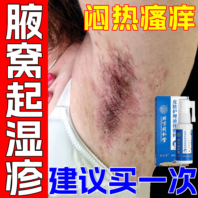 腋下瘙痒起红疹止痒膏 胳肢窝起湿疹腋毛癣白色附着物腋窝藓腋下淹红