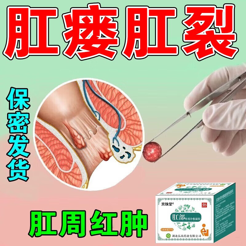 肛瘘内口封口膏 治肛周脓肿湿痒疹瘙奇痒肛裂愈合膏大便出血拔脓封口