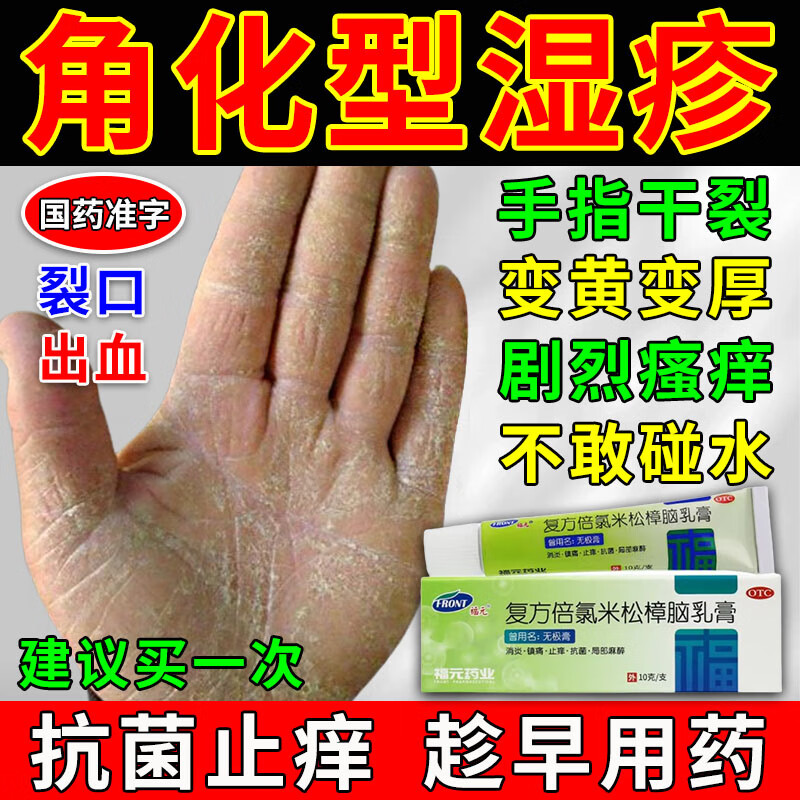角化型湿疹药】手指皲裂性湿疹药膏手指脱皮瘙痒干裂止痒去皮炎湿疹