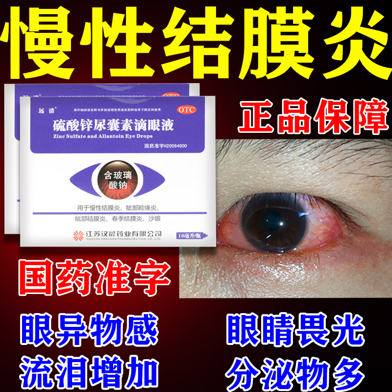 眼药水疲劳 眼干眼涩 视力模糊痒干眼症眼药水 硫酸锌尿囊素滴眼液 一