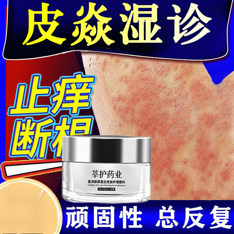 湿疹膏去痒止根皮肤瘙痒成人真菌感染皮炎毒清大腿内侧肛门阴囊私处痒