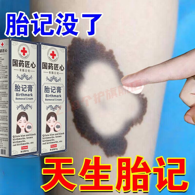 确邦胎记去除神器胎记去除膏去胎记脸部去除神器 1支装