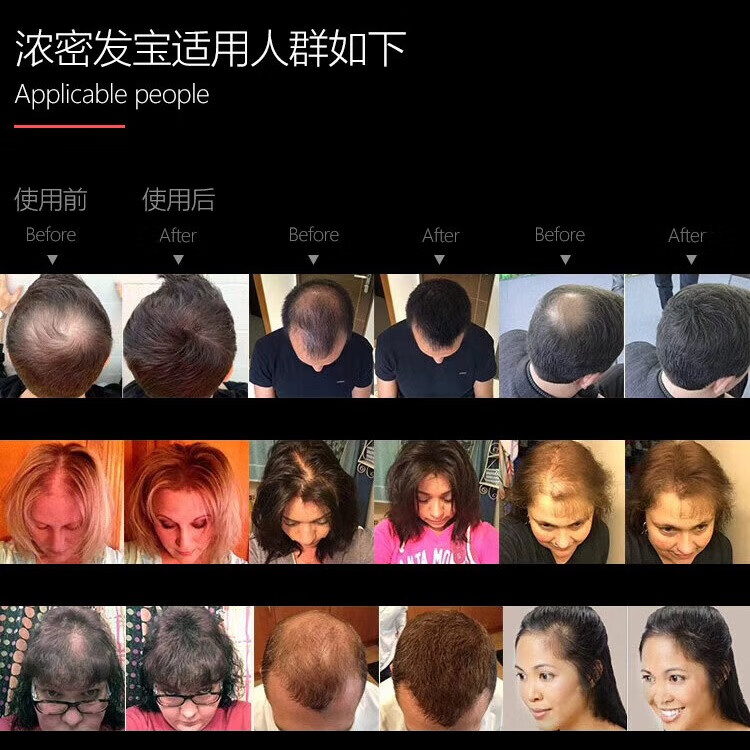 DexeDexe黑浓增头发纤维假发美发粉浓密头发宝补发男女头发快速 经典深+3瓶超值装
