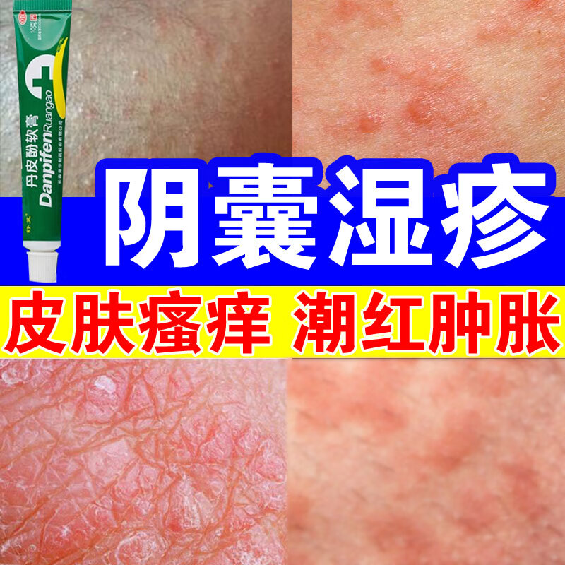 阴囊湿疹男人专用药】治阴囊潮湿瘙痒有疙瘩红肿疼痛私处睾丸痒有异味