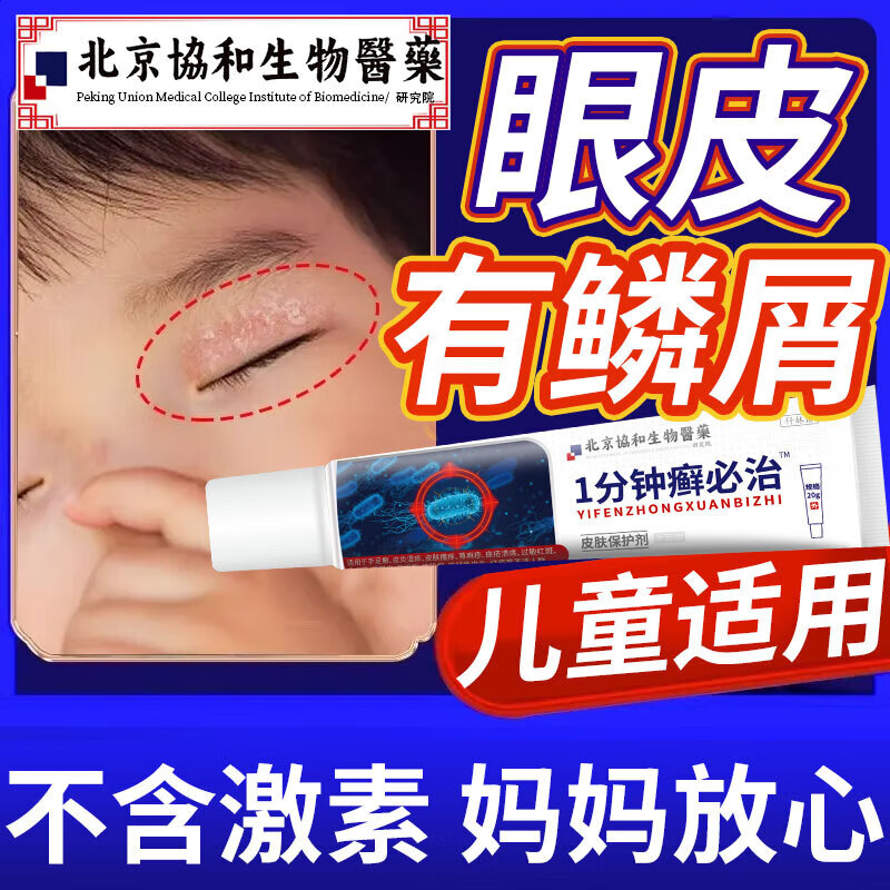 儿童眼皮癣专用膏过敏干燥眼皮过敏红肿痒眼角痒脸上起癣干皮干痒脱屑