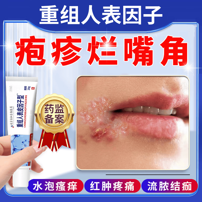 春天嘴唇疱疹上火专用的药监备案嘴角溃烂软膏口角炎嘴角干裂疼痛脱皮