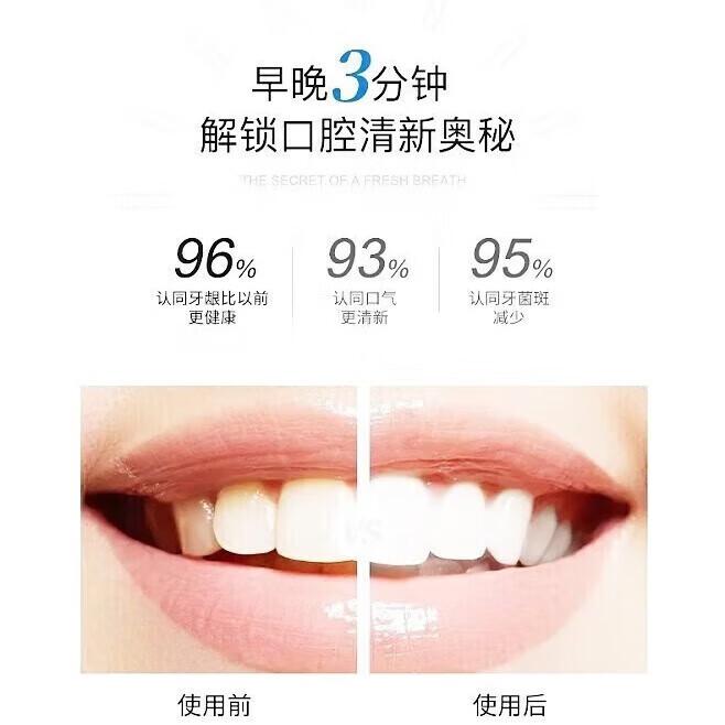 云南本草幽门螺螺杆菌牙抑菌杀菌除门螺螺菌 两支
