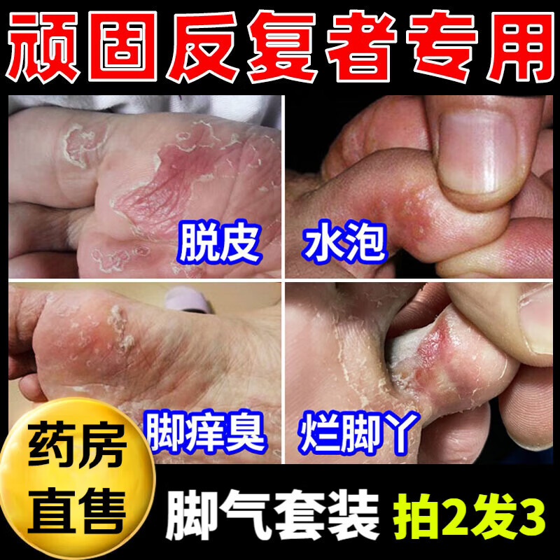 十心堂套装脚痒脱皮水泡型十心堂真菌感染香港脚烂脚丫专用