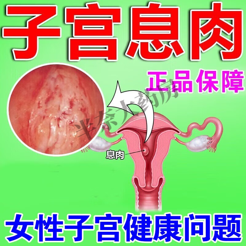 子宫内膜息肉贴宫颈息肉子宫内膜厚薄肌瘤囊肿月经不调异常出血白 单