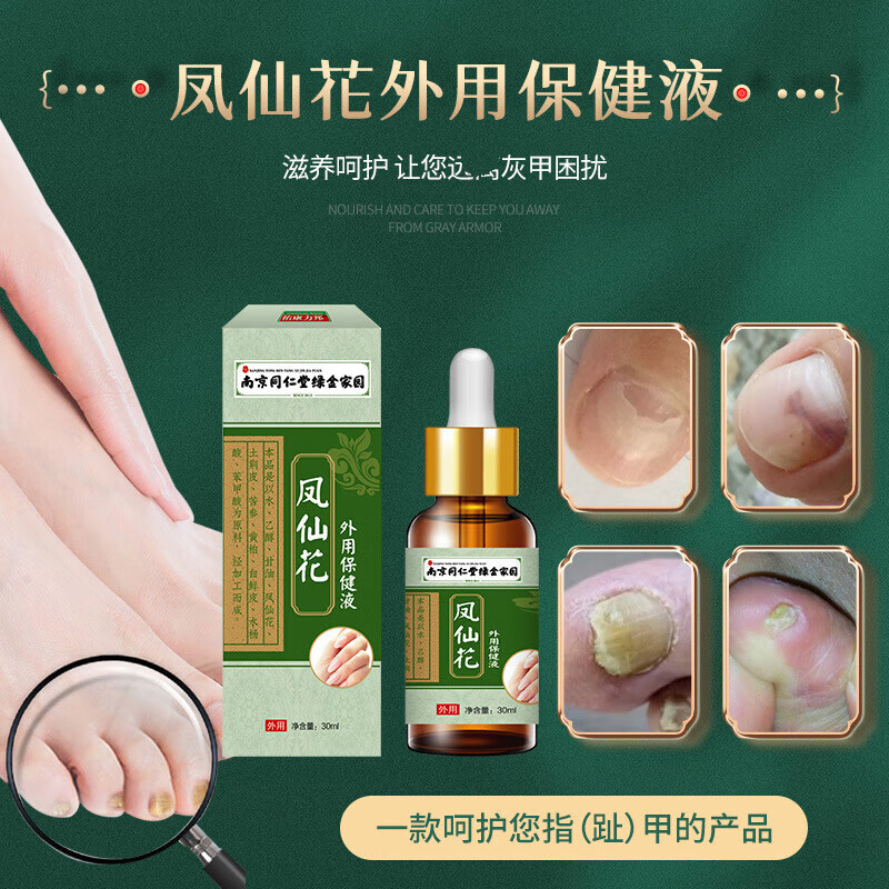 外用保健液南京同i仁堂凤仙花外用液30ml足部护理灰指甲液甲沟修复液