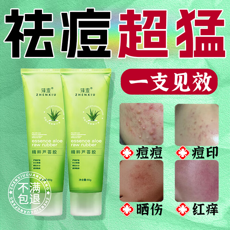 臻羞芦荟胶祛痘淡化痘印舒缓呵护晒后修复肌肤补水保湿男女60g