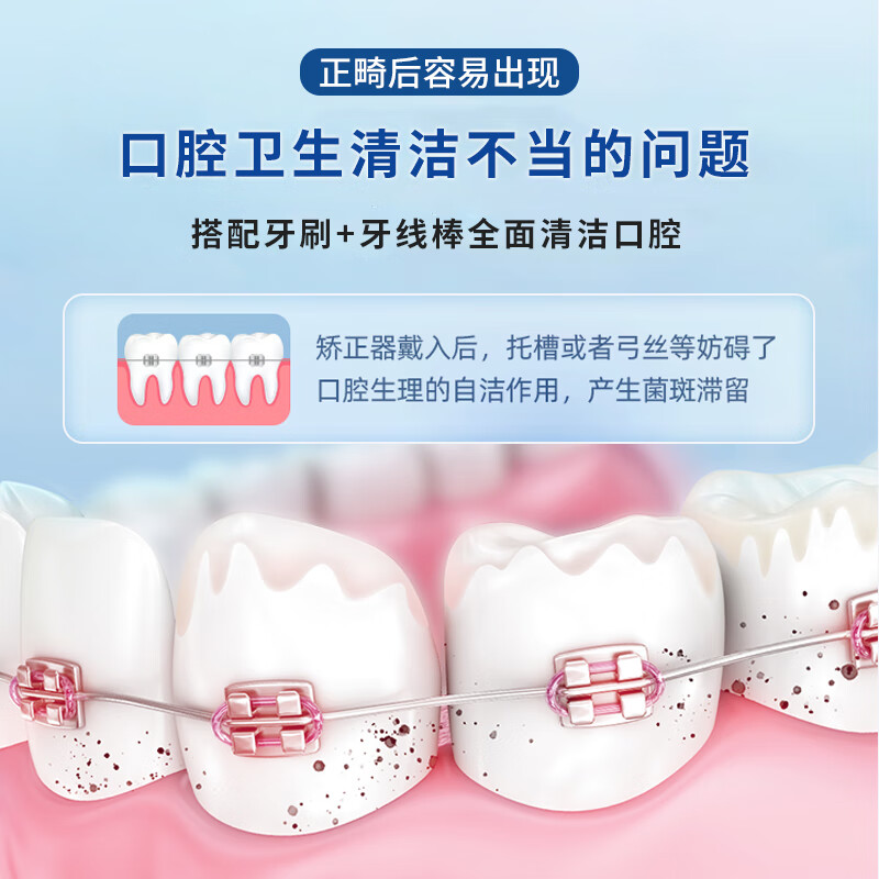 联氏迪科 正畸双线牙线棒 清洁齿缝 牙齿矫正钢丝牙套箍牙适用  二盒100支