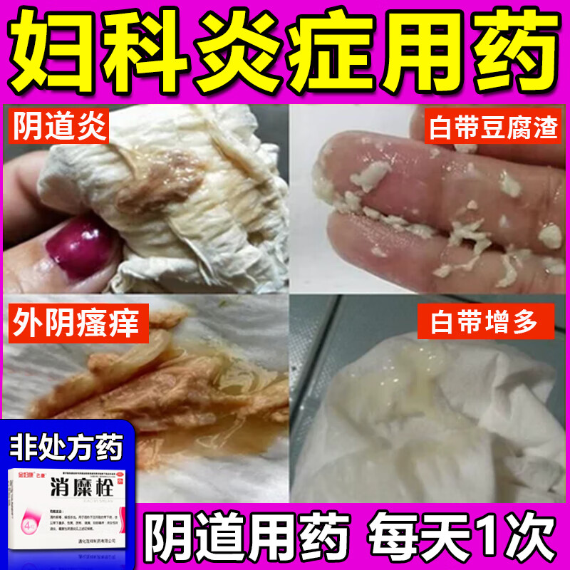 消糜栓妇科栓剂炎症性瘙痒药女性私处豆腐渣白带异常等妇科消炎药 治