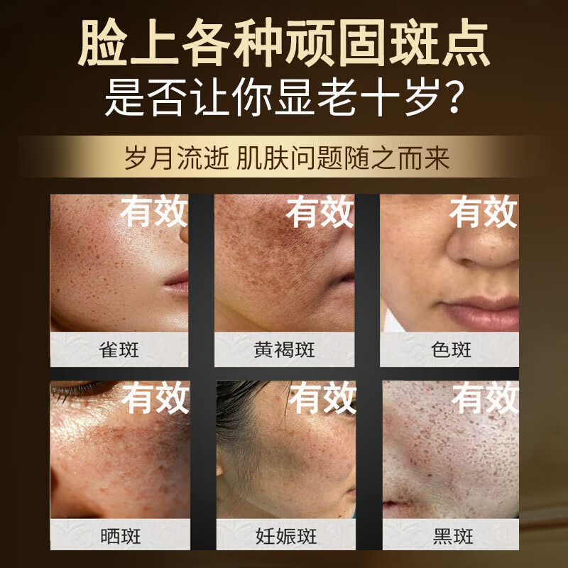 南京同仁堂祛斑美白淡化黑色素烟酰胺凝胶祛斑霜去斑 50g