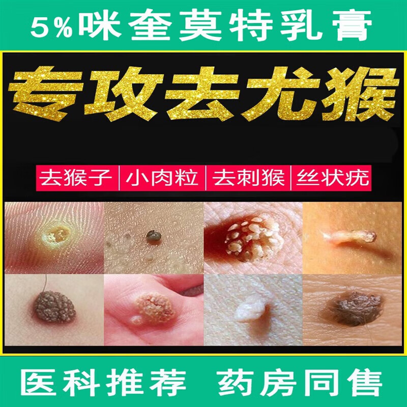 咪喹i莫特软膏5%软膏品正丝状扁平疣hpv刺瘊脖子上长小肉粒官方舰旗店