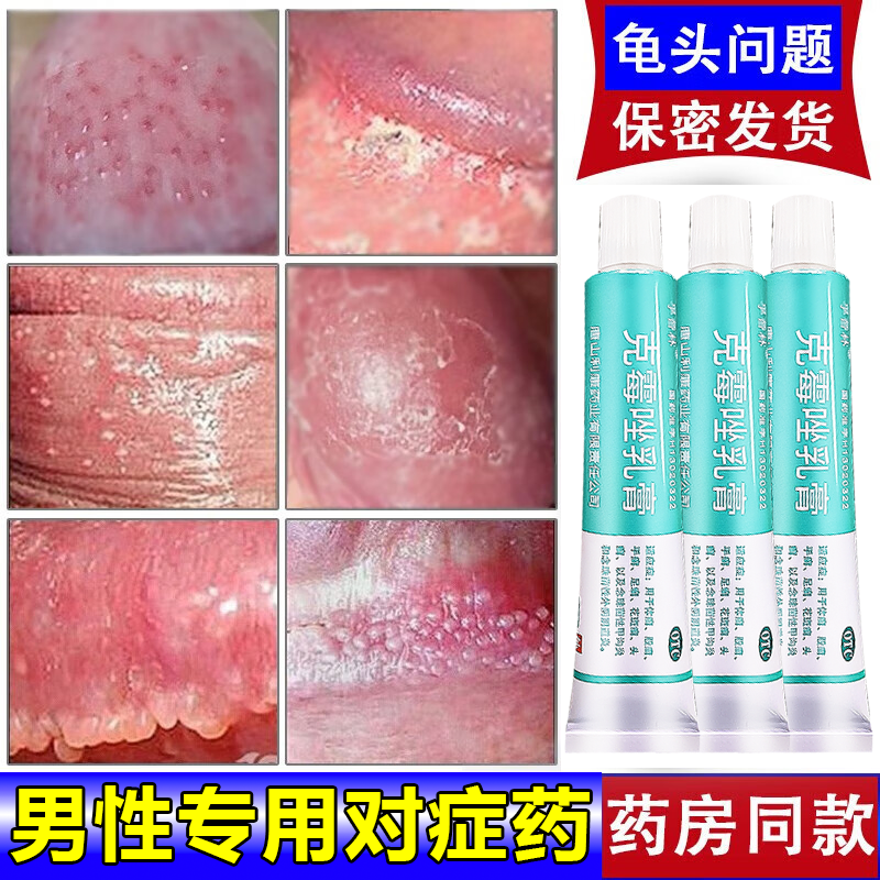 菌霉菌专用药男性私处止痒杀菌外用药膏抗真菌感染 三盒(龟i头珍珠疹