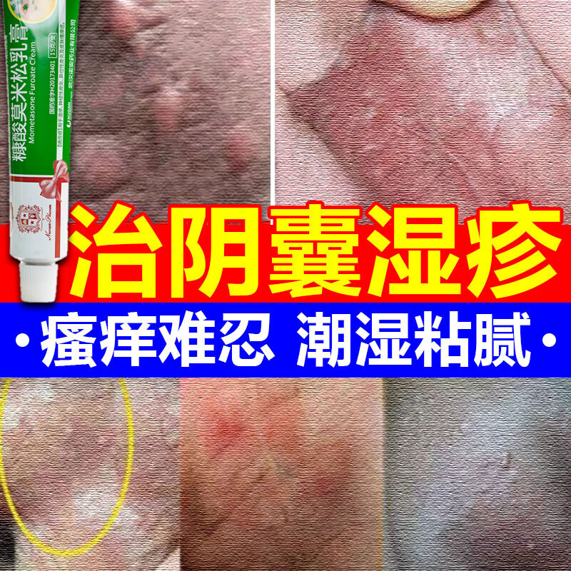 糠酸莫米松乳膏阴囊湿疹止痒去阴根囊瘙痒治疗男性阴囊湿疹阴囊潮湿