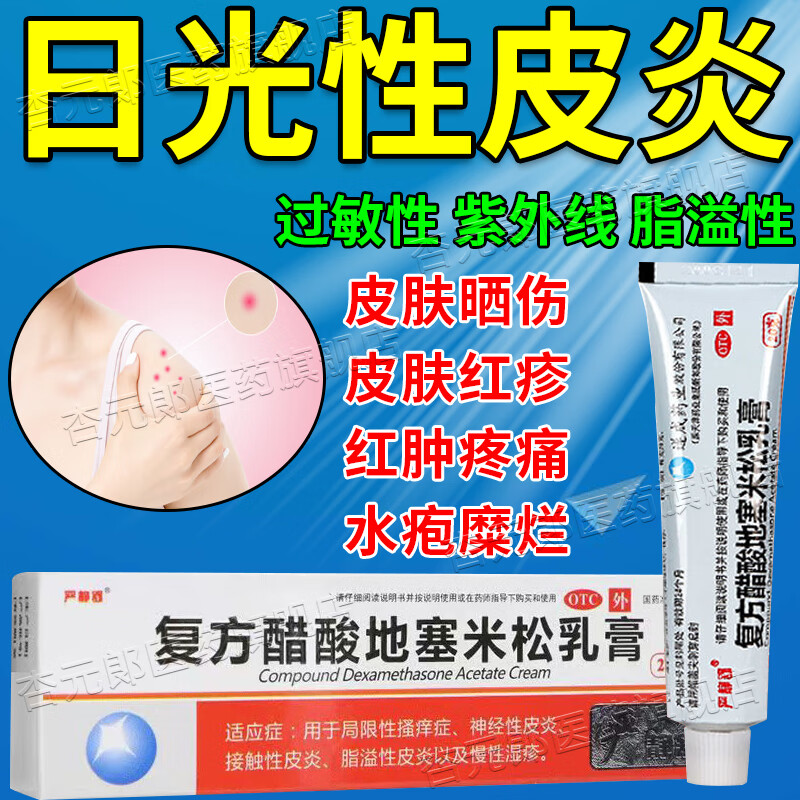 治日光性皮炎专用药膏 皮炎湿疹皮癣真菌感染止痒膏紫外线过敏药皮肤
