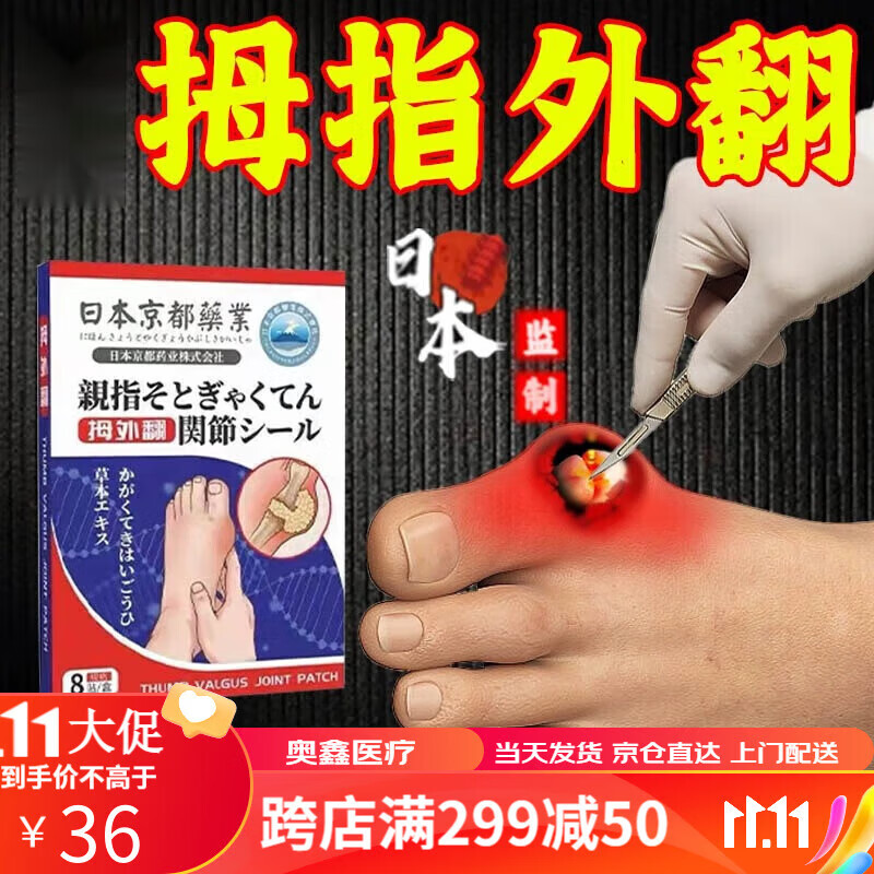 关节贴适用于拇指外翻矫正脚大拇指外翻矫正拇指变畸形重叠大脚骨突出