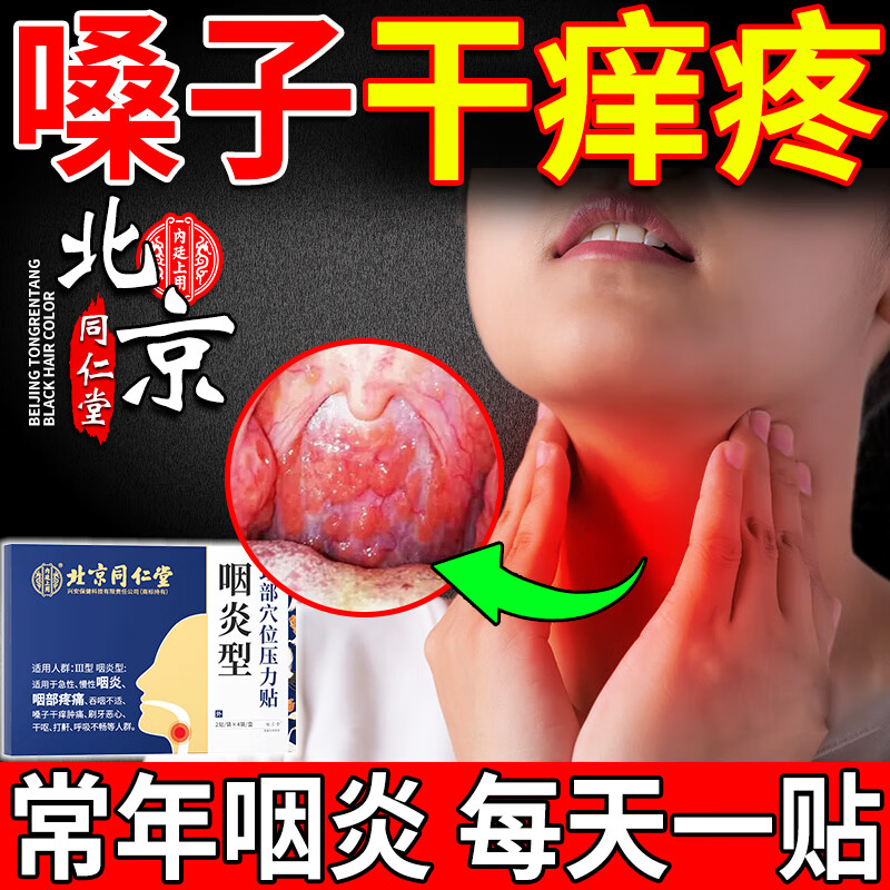 北京同仁堂咽炎贴嗓子干痒疼重度急慢性喉咙干呕痒异物感急慢性咽炎