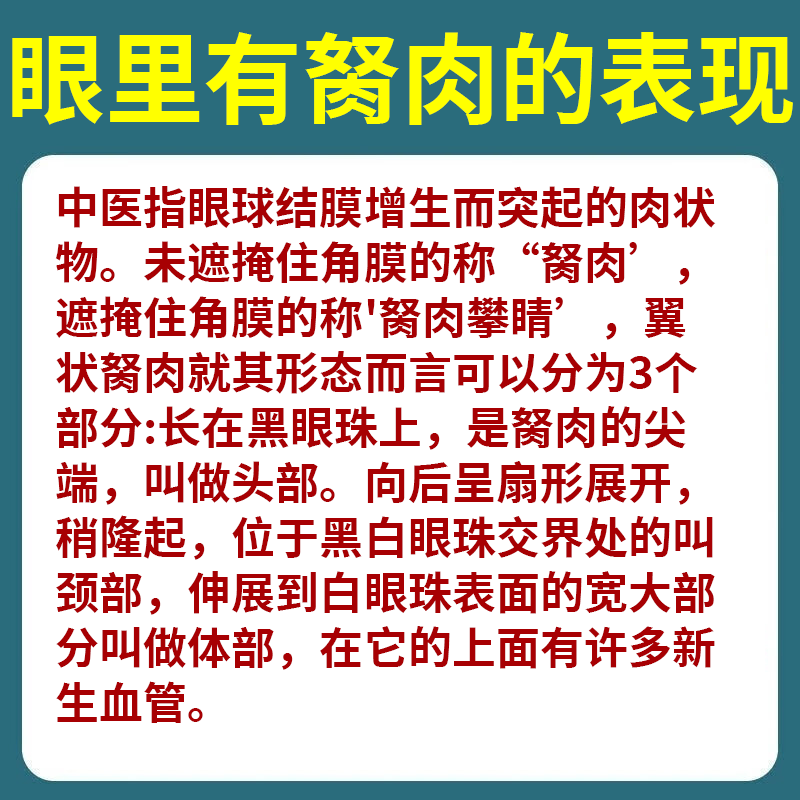 熊胆滴眼液 去翼状胬肉胬肉攀睛去翳明目眼睛浑浊发痒有异物感眼药水