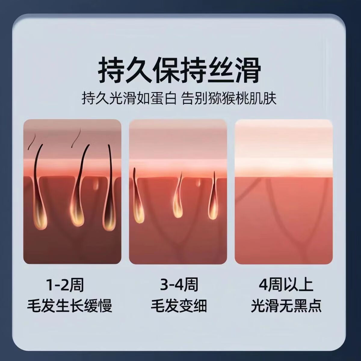 810拉杆箱脱毛仪808冰点无痛永久脱毛嫩肤家用医用便携式洗眉机激 新款二代810白色【5根耙条】