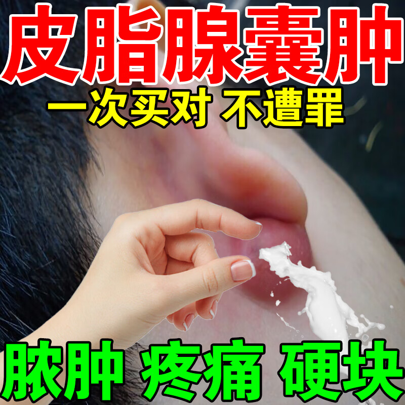 耳后囊肿皮脂腺囊肿专用抹药粉瘤消除膏皮下痘痘粉瘤增生火疖子脓包脓