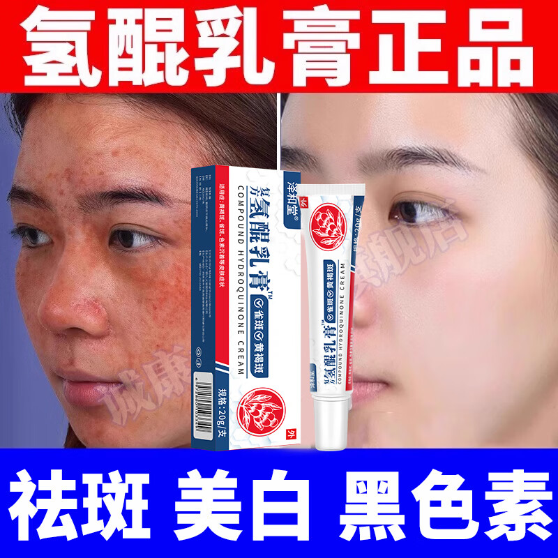氢醌医用乳膏 氢醌霜乳膏分解黑色素沉淀复方熊果苷乳膏 祛斑氢醌霜