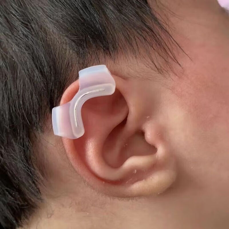 碧琢婴儿耳朵矫形器内置小儿贴耳廓贴纠正塑形耳轮定型 b款左耳矫型