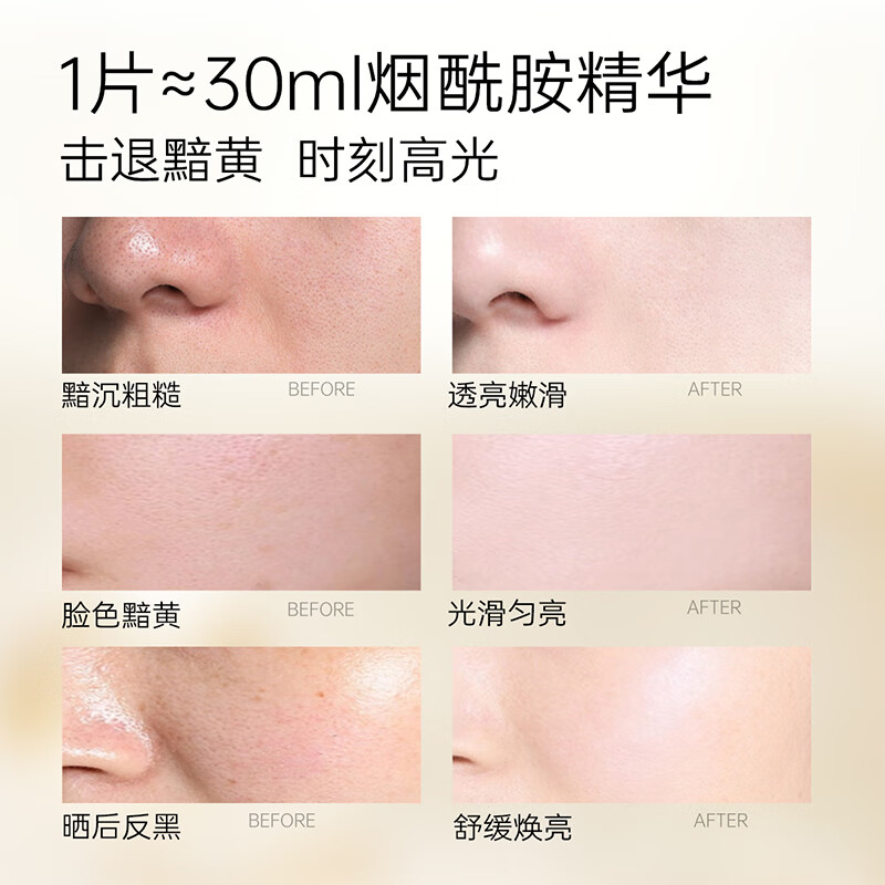 优理氏(UNES) 烟酰胺安瓶面膜深层补水保湿全脸提亮紧致润肤改善暗沉滋养舒缓 【40+2片】烟酰胺提亮面膜