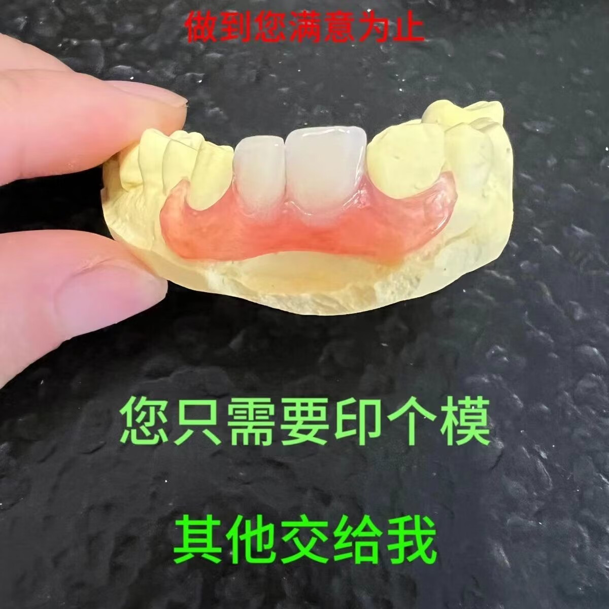 牙科同款定制隐形义齿牙齿遮丑临时假牙定做义齿假牙套仿真树脂牙 3颗牙＋基托