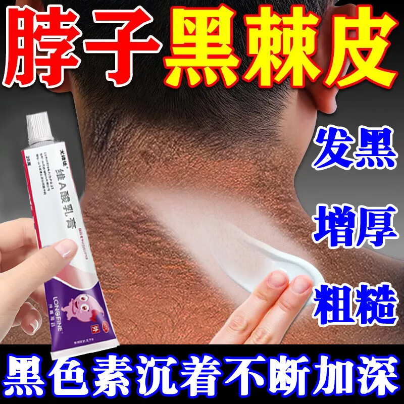 维a酸乳膏黑棘皮病治脖子黑色素去除黑色素沉淀去除唇周私处粉嫩淡化