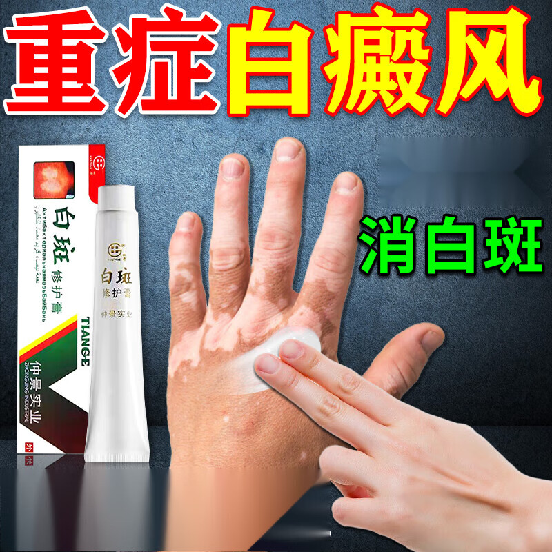 白斑色素脱失促进黑色素生长快速消白斑专用膏乳膏营养不良奇白消软膏