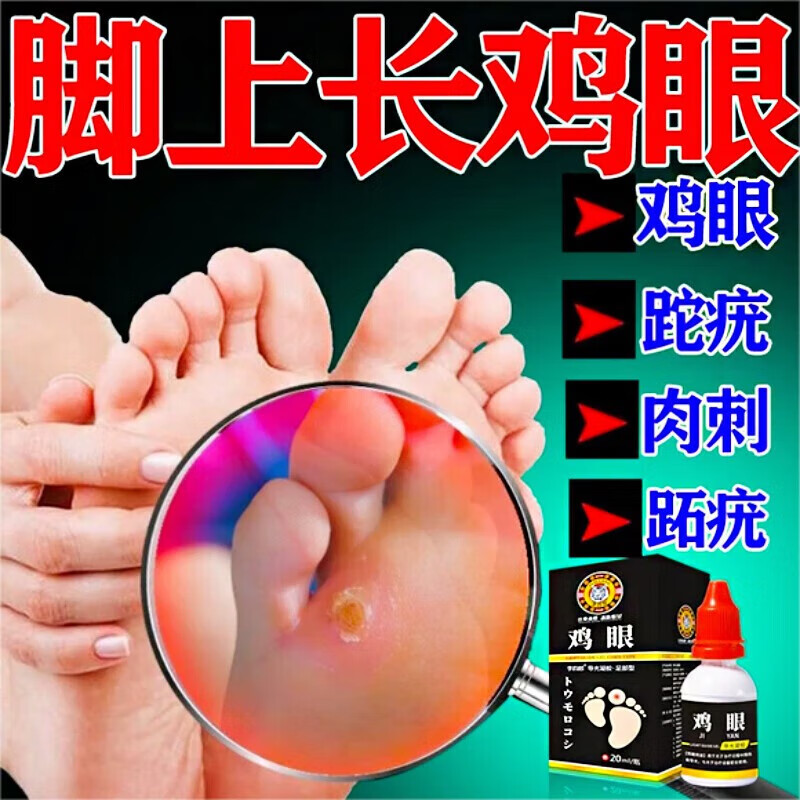 药水去除1根跖疣去脚后根手部老茧脚底趾疣瘊子刺猴甲周疣软膏专用 单