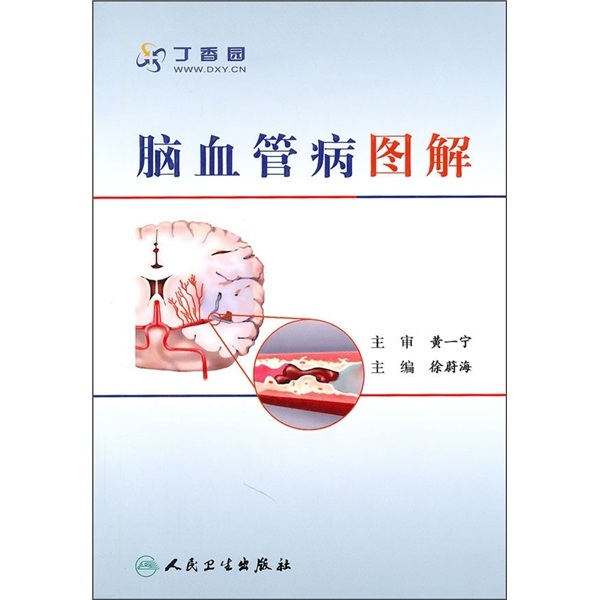 脑血管病图解-徐蔚海著