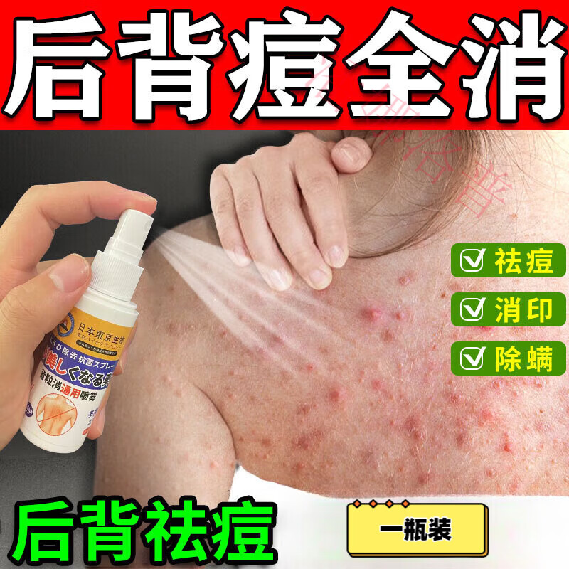 through gui 【官方】背部祛痘喷雾痘痘后背祛痘背上长去除喷雾除螨虫
