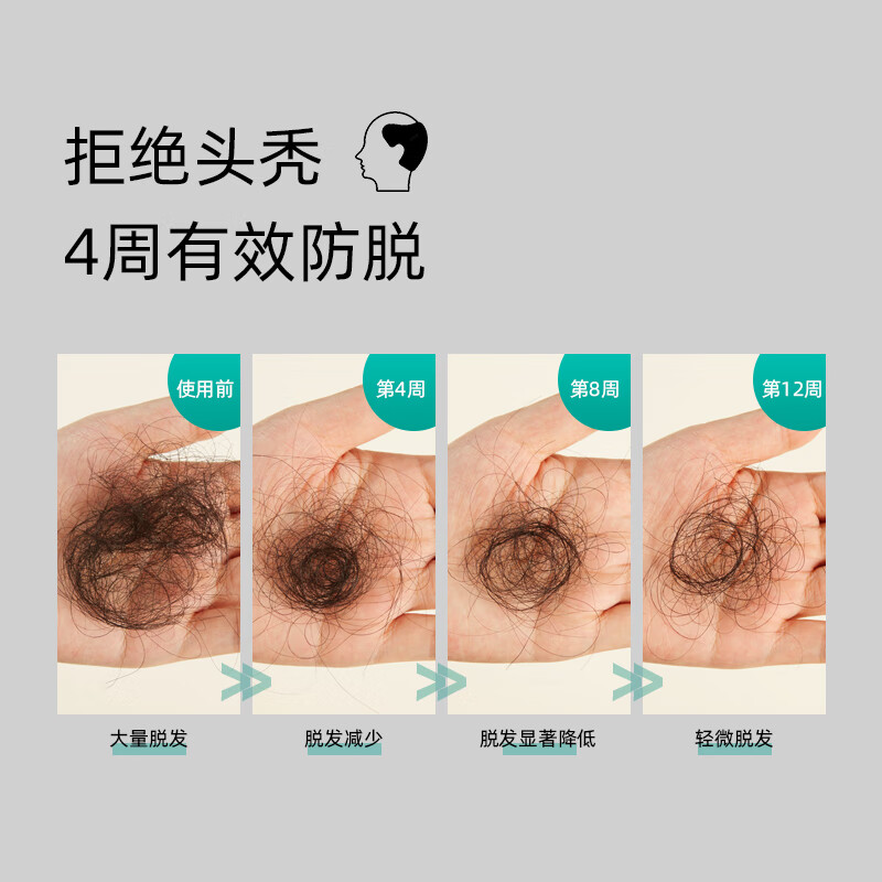 史云逊优丽科头皮护理防脱精华液6ml*15支装ALT【效期至2025-10-13】 优丽科防脱头皮精华液ALT6ml*15