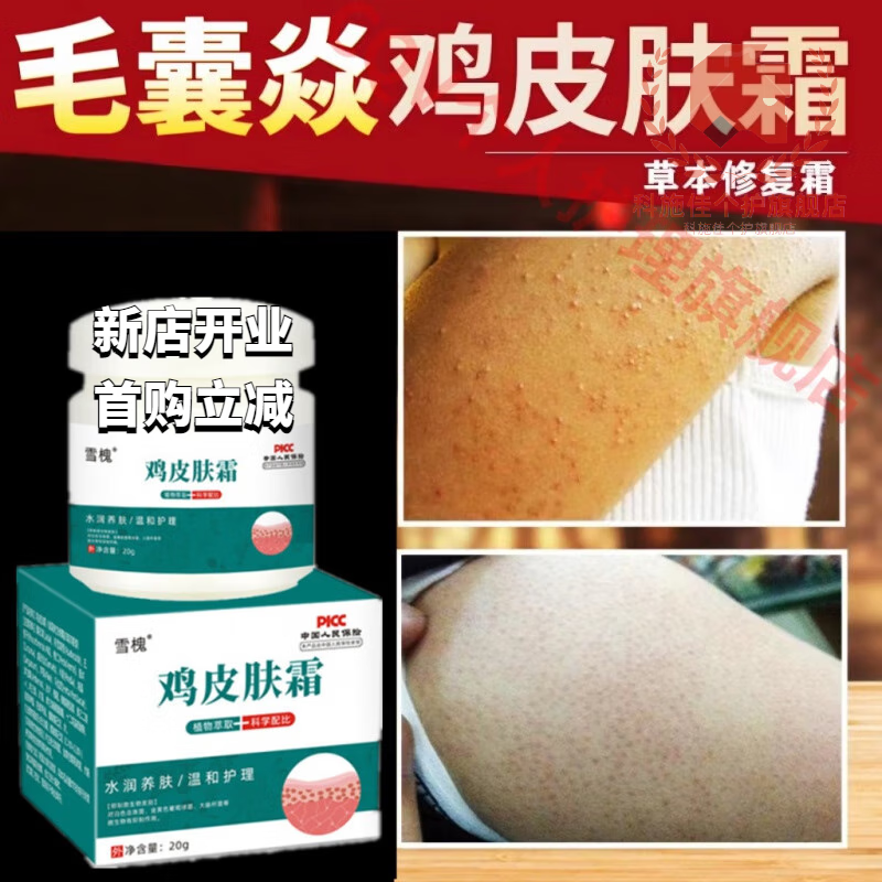 贝因维丝(beiyvs)鸡皮疙瘩祛除膏腿上手臂鸡皮肤毛囊周角质化神器维e