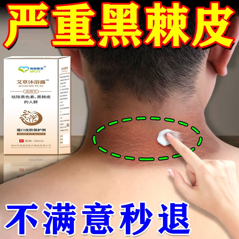黑棘皮病治脖子黑色素去除沉淀脖子黑黑的男女全身脸部腋下私处粉 1