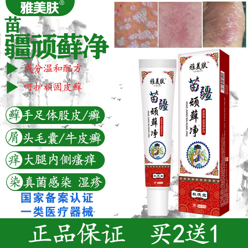 雅美肤牛皮癣专用股癣大腿内侧瘙痒红疹止痒膏苗疆顽藓净手足癣真菌感染 苗疆顽藓净软膏【20g/支】